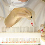 Albasure敏感性控制的常规相容性和抗体筛选试验